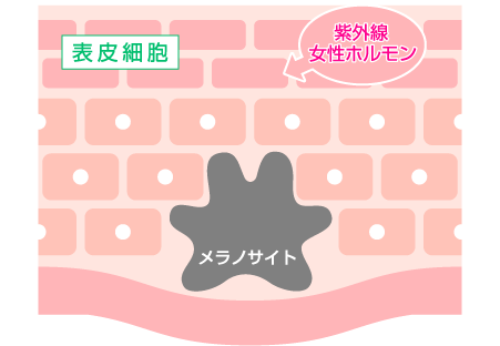 しみができるメカニズム1