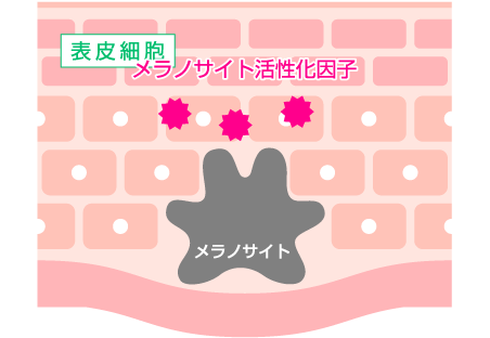 しみができるメカニズム2