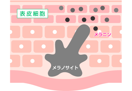 しみができるメカニズム4